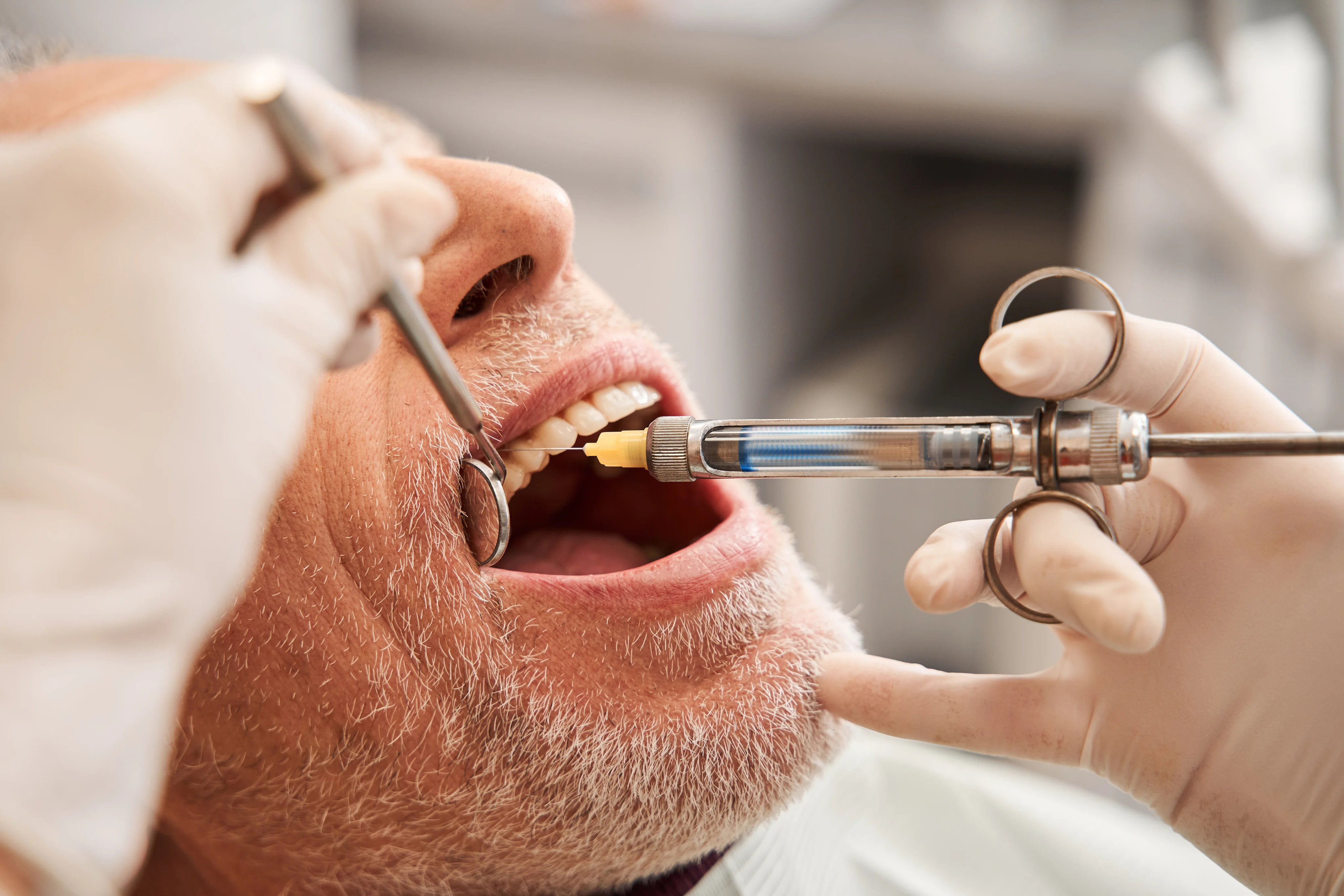 Dental anesthesia procedure